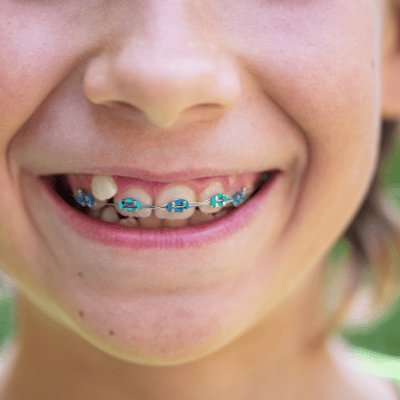 Holbert Family Orthodontics child see an orthodontist